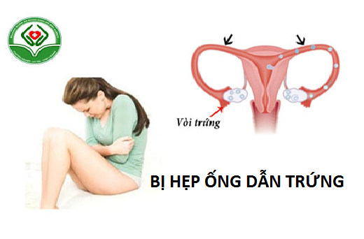 Bị hẹp ống dẫn trứng