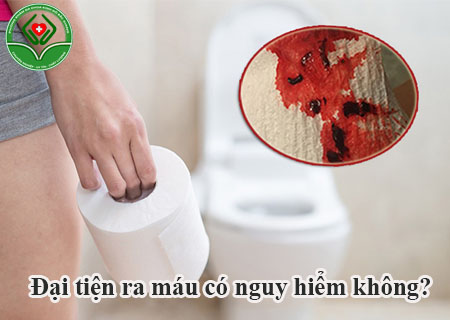 Đại tiện ra máu gây nhiều biến chứng