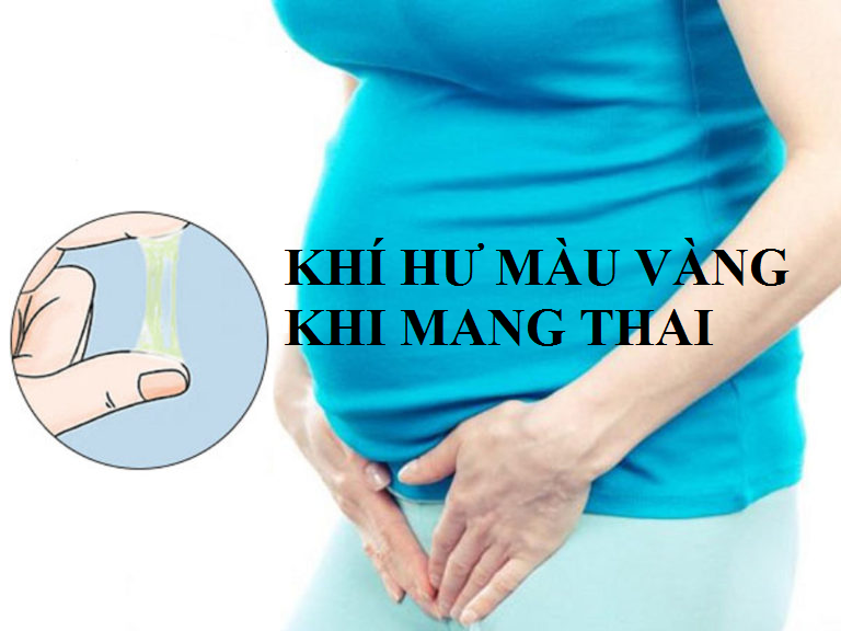 Đừng chủ quan khí hư màu vàng khi mang thai