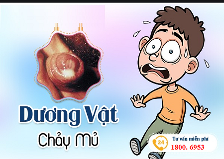 duong-vat-chay-mu