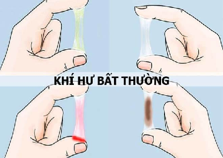 Khí hư bất thường là bệnh gì?