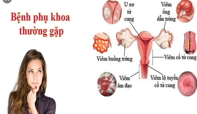 Những bệnh phụ khoa thường gặp