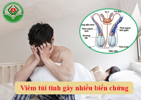 Nam giới chớ chủ quan với bệnh viêm túi tinh