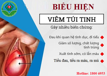 Các triệu chứng của bệnh viêm túi tinh