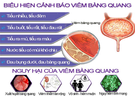 Tác hại của bệnh viêm bàng quang