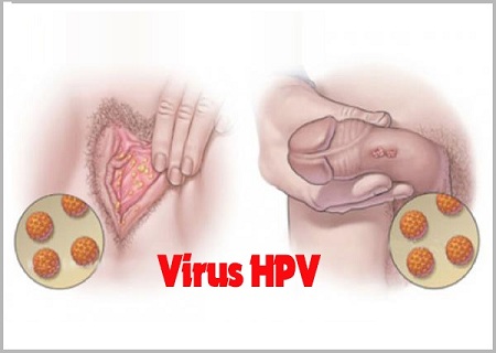 VIRUS HPV – CĂN NGUYÊN GÂY BỆNH SÙI MÀO GÀ SINH DỤC