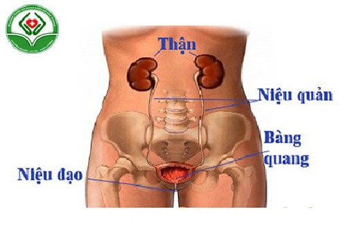 Bệnh viêm đường tiểu hãy cẩn trọng