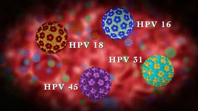 Bị HPV đừng chủ quan kẻo nguy