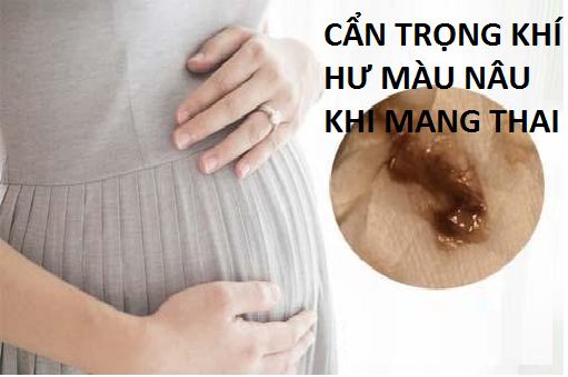 Cẩn trọng khí hư màu nâu khi mang thai