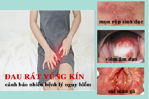 Cực sốc với nguyên nhân âm đạo bị đau rát