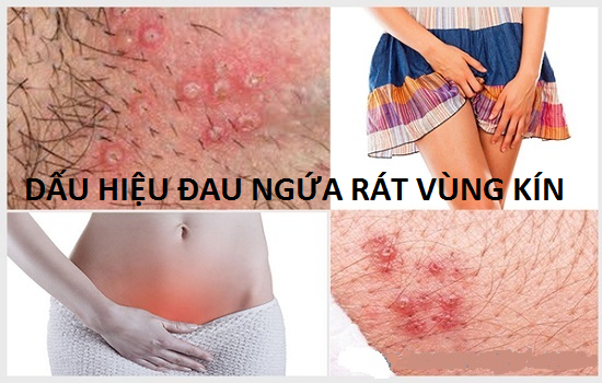 Dấu hiệu đau ngứa rát vùng kín