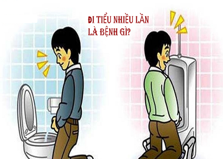 NAM GIỚI ĐI TIỂU NHIỀU LẦN TRONG NGÀY LÀ BỊ LÀM SAO? CÓ NGUY HIỂM KHÔNG?