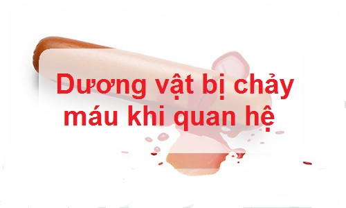 Quan hệ ra máu ở nam cảnh báo nguy cơ tiềm ẩn