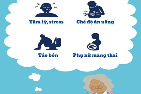 Bệnh trĩ hỗn hợp là gì? Cách điều trị d.ứt đ.iểm trĩ hỗn hợp