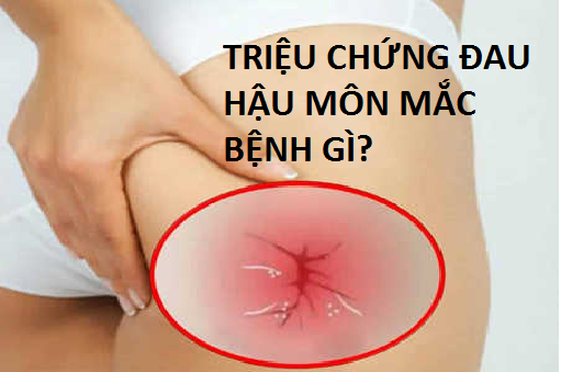 Triệu chứng đau ở hậu môn mắc bệnh gì