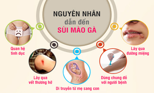 Nguyên nhân mọc sùi mào gà ở vùng kín