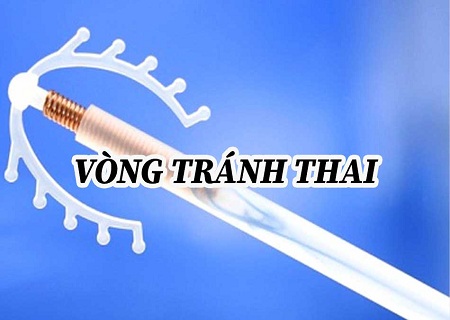 ĐẶT VÒNG TRÁNH THAI NHƯ THẾ NÀO LÀ ĐÚNG CÁCH?