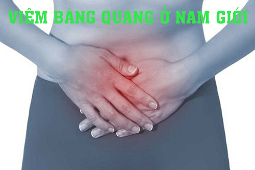 Viêm bàng quang ở nam giới và những điều cần lưu ý