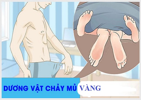 duong-vat-chay-mu-vang