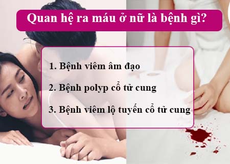 Giải đáp quan hệ ra máu là bệnh gì