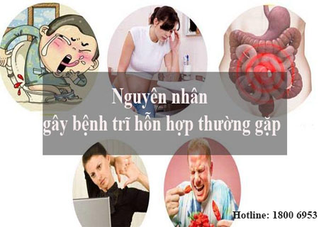 Nguyên nhân gây bệnh trĩ hỗn hợp