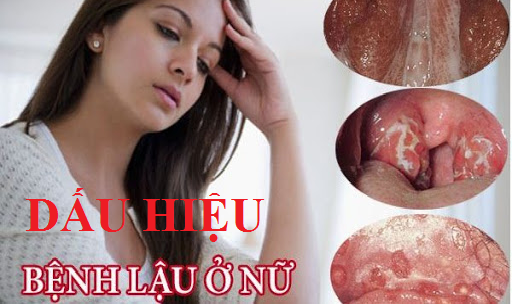 Nhận diện 5 dấu hiệu lậu nữ