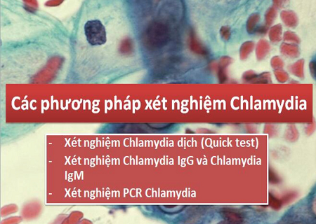 Xét nghiệm chlamydia dương tính