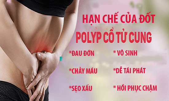 Đốt polyp cổ tử cung có thực sự tốt?