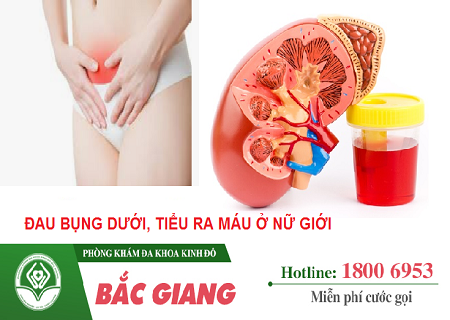 Đau bụng dưới đi tiểu ra máu ở nữ