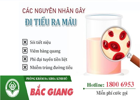 Đi tiểu ra máu – nguyên nhân