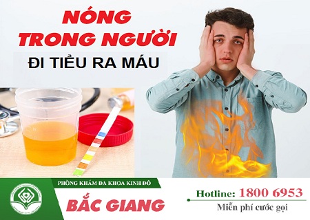 Nóng trong người đi tiểu ra máu